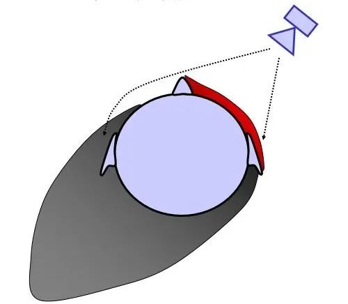 助听器只戴一只行不可?当心另一侧耳朵退化!4 助听器只戴一只行不可?当心另一侧耳朵退化!4