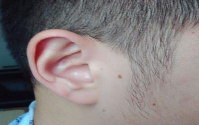 第一次戴助听器，听到声音是什么感觉？