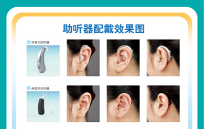 客户分享：分享我了解的一些助听器知识
