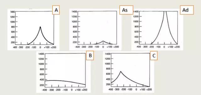 声导抗测试 声导抗测试