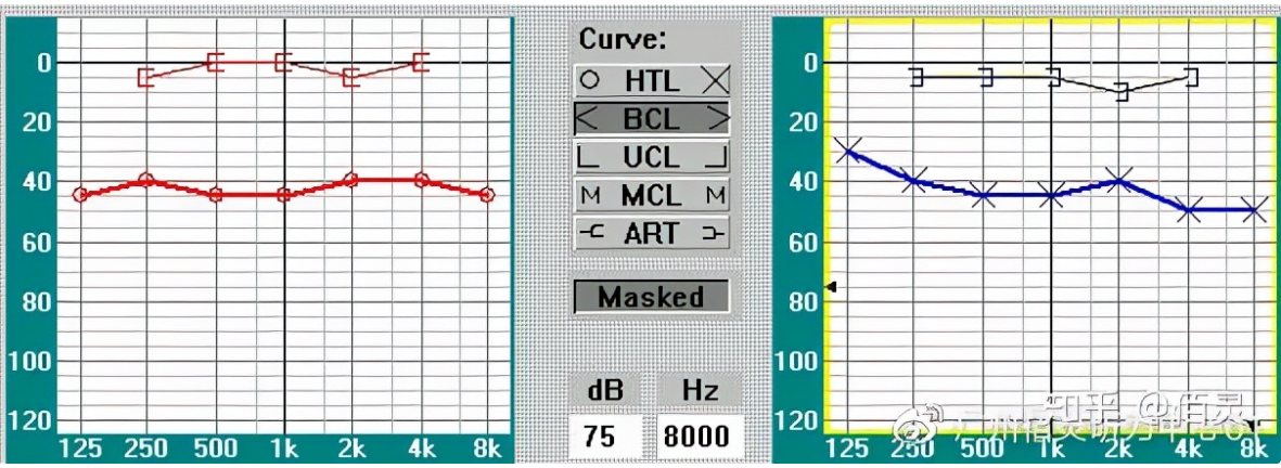 深圳欧维助听器教你轻松看懂纯音听力图（图2）