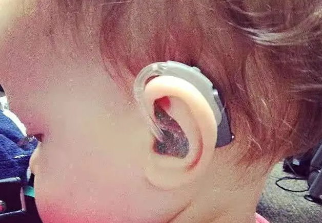 峰力助听器是否值得选择呢？