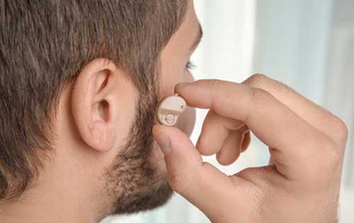 隐藏式助听器有哪些类型?