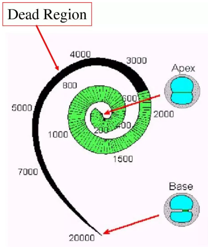 佩戴了助听器还是听不清楚 或是陷入“耳蜗死区”(图3）