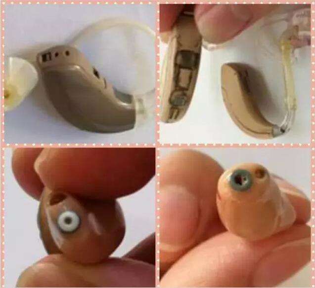 助听器外壳上有个洞洞有啥用途？