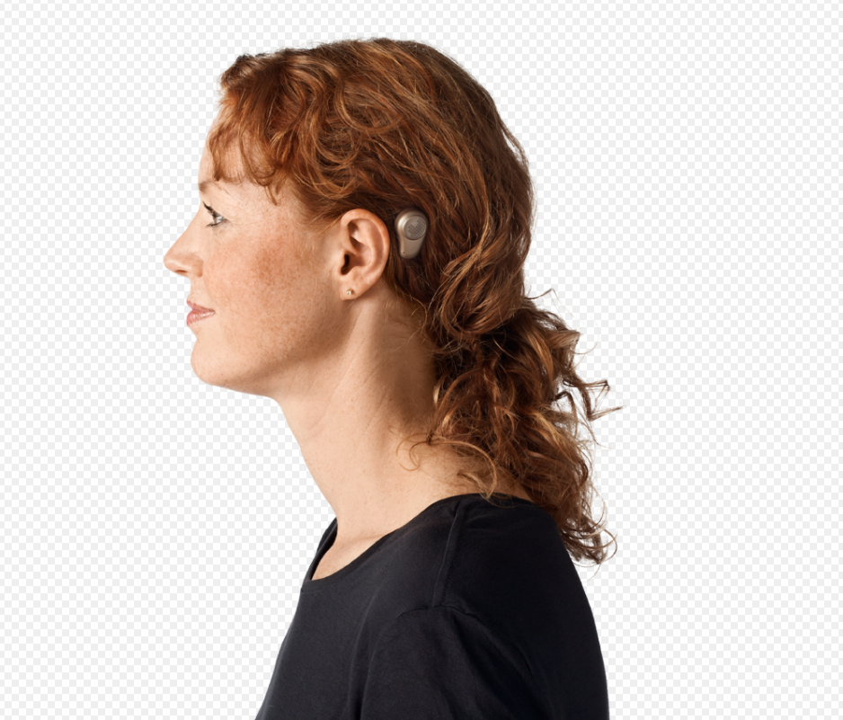 耳后的声音处理器