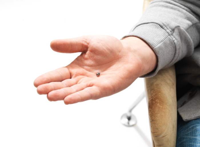 成人手中实际尺寸显示的植入物