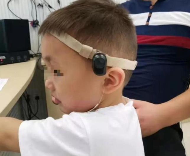 image 　　骨导助听器适合什么人群使用？