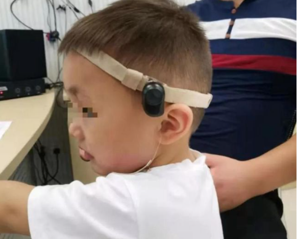 骨导助听器适合何种类型的听损？