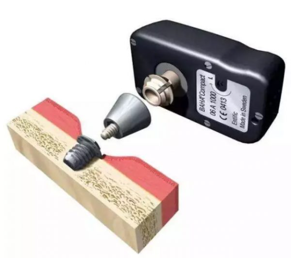 谁使用骨导助听器