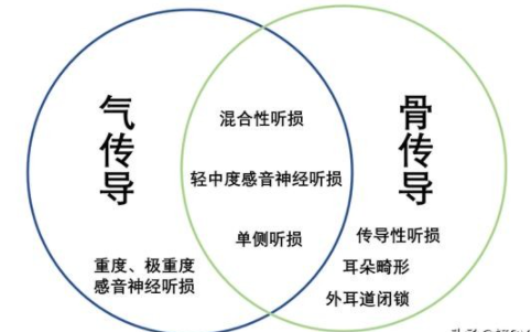 骨传导助听器的缺点有哪些？