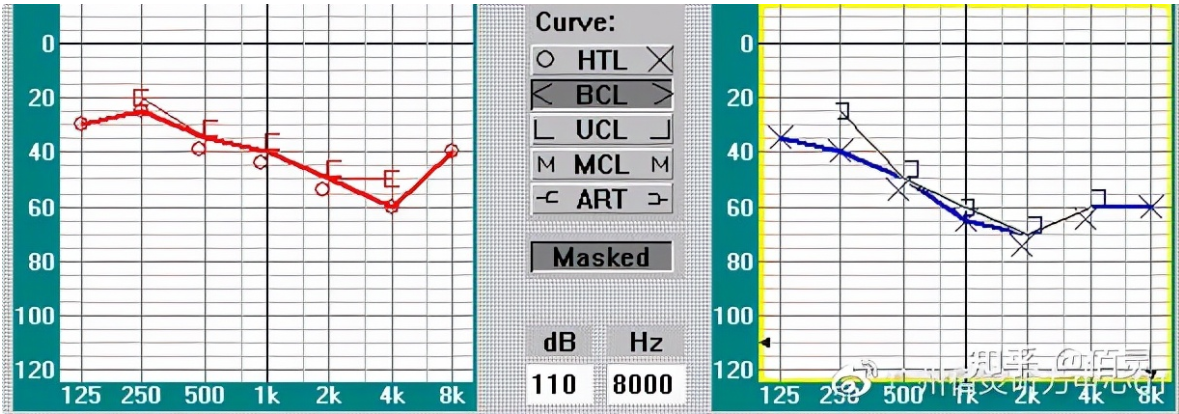 深圳欧维助听器教你轻松看懂纯音听力图（图3）