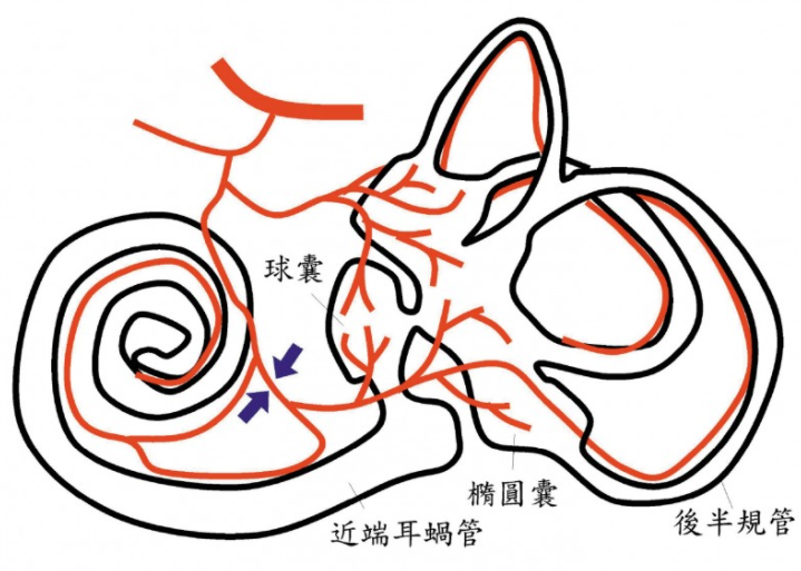 走路轻飘听到嗡嗡声 耳中风征兆