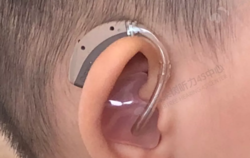 助听器使用说明书之儿童篇，建议收藏！