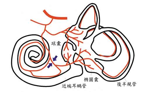 走路轻飘听到嗡嗡声 耳中风征兆